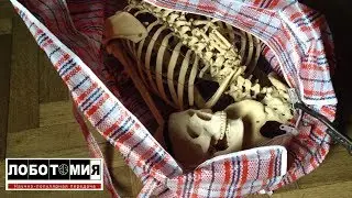 Разум в огне: что делать, когда вырабатываются антитела к клеткам собственного мозга