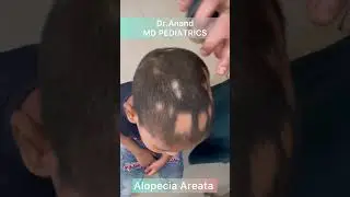 Pediatric dermatology - spot diagnosis ?