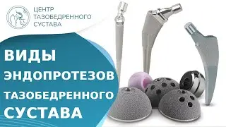 🦿 Какой вид эндопротеза тазобедренного сустава лучше? Виды эндопротезов тазобедренного сустава. 18+