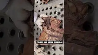 Palate and Nasal Conchae #18 | Anatomy Head and neck | #mbbs #neet #viral #shorts #shortfeed