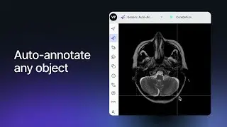 V7 for Medical Image Annotation & Model Training