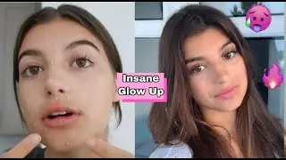 INSANE glow up *natural* (diy big lips + soft skin)