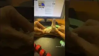 Основные элементы ортопедических стелек