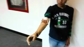 Flexy arm II thermoformed