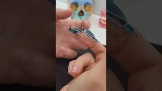 Функциональная стоматология,  аппарат Бимлера.  