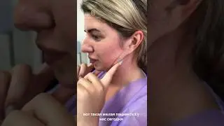 Исходные данные пациентки на подтяжку шеи и пластику носа #платизмопластика #ринопластика