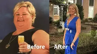 Benta's 300lb Transformation from Singing River Weight Loss