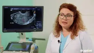 Gynecology and abortion: answers to the most common questions | Dr. Silina