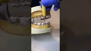 Dental hygiene instrument Montana Jack on posterior teeth @visualdh