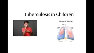 Pediatrics 251 Tuberculosis in Children Symptoms Diagnosis Treatment