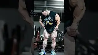 What happened to Nick Walker’s Calves?