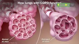 4 Organ Yang Rusak Akibat Merokok