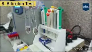 Bilirubin test (in hindi) | Bilirubin test procedure |Total bilirubin | Direct Bilirubin |