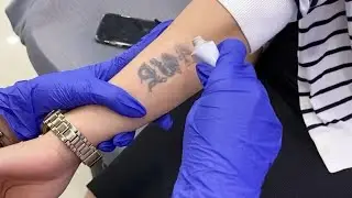 HAPUS TATTO TERMURAH DI JAKARTA BARAT