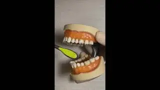 TECNICA DE BARRIDO