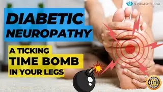 Prevent Leg pain Due to Diabetes!!! | Diabetic Neuropathy