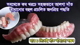 কম খরচে দাঁত বাধানো সহজ পদ্ধতি |Denture| আলগা দাঁত লাগানোর জনপ্রিয় পদ্ধতি @DentalHealthTips