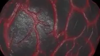 Organic Morph