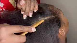 ASMR scalp scratching dandruff removal so relaxing #asmr #scalp