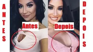 BOCA ROSA PÔS SILICONE NOS PEITOS