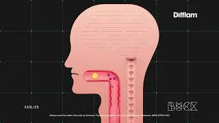Difflam TVC