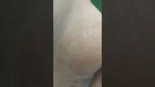 Волшебная формула для удаления трещин
