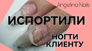 SEPARATION OF THE ENTIRE NAIL / complex cuticle / individual selection of cutters / how to say NO...