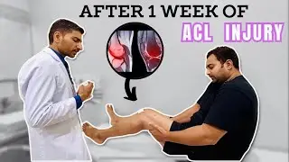 ACL Injury Recovery Time | After 1 Week Of ACL Injury