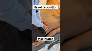 Navel reposition treatment 