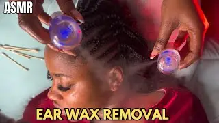 ASMR✨ DIRTIEST EAR DEEP CLEANING WITH BUDS& MIST SPRAY ” SATISFYING EAR WAX REMOVAL FOR DEEP SLEEP
