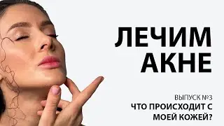 Что происходит с моей кожей?