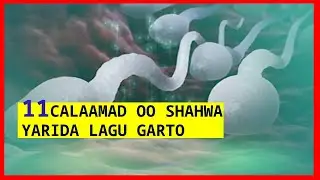 11 calaamad shahwa yarida lagu garto iyo sababaha guud           11 symptomes of low sperm