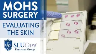 How skin is Processed and Evaluated During Mohs Surgery