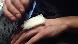 Накладка повязки на рану/Помощник не нужен