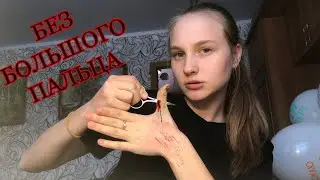 избавляюсь от пальца