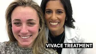 Is Microneedling worth it? Yes!