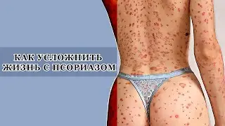ЧТО МОЖЕТ УХУДШИТЬ ПСОРИАЗ #PSORIK