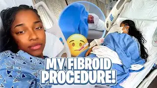 Uterine Fibroids Embolization Recovery/ Procedure. 🤒🤕