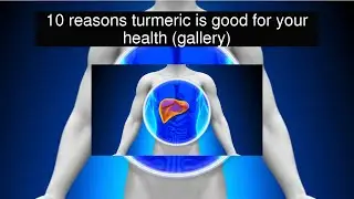 10 reasons turmeric is good for your health (gallery)