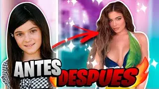 CELEBRIDADES QUE SE EXCEDIERON CON LAS CIRUGÍAS PLÁSTICAS💉🩸