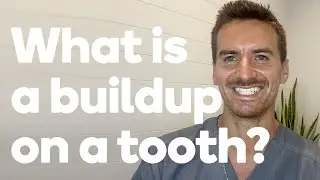 What is a buildup and how is it done?
