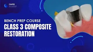 Class 3 Composite Restoration | | Full Course on Link Below
