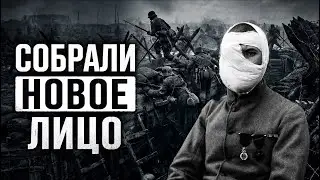 Пластическая Хирургия В Первую Мировую Войну