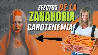 Efectos de la Zanahoria 🥕 ¿Te pones color naranja? Dr. Ludwig Johnson