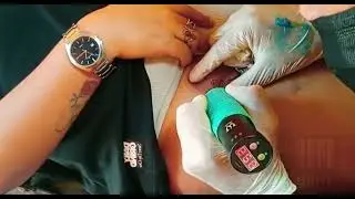 tato diatas memek tembem berbulu tipis