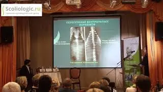 Корсет Шено.  Лечение сколиоза у детей.