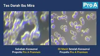 Pro A - Melancarkan system peredaran darah #Propolis #Proa #herbal #suplemen #propolisterbaik