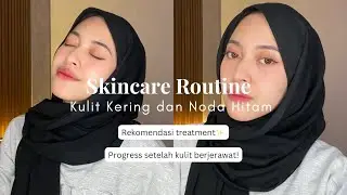 MY SKINCARE ROUTINE and TREATMENT RECOMMENDATION Untuk Kulit Kering dan Noda Hitam Bekas Jerawat🥰🤍