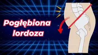 Wystający brzuch i pośladki? To hiperlordoza - skorygujmy to