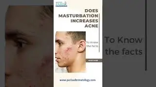 Facts : You should know about Masturbation and Acne 